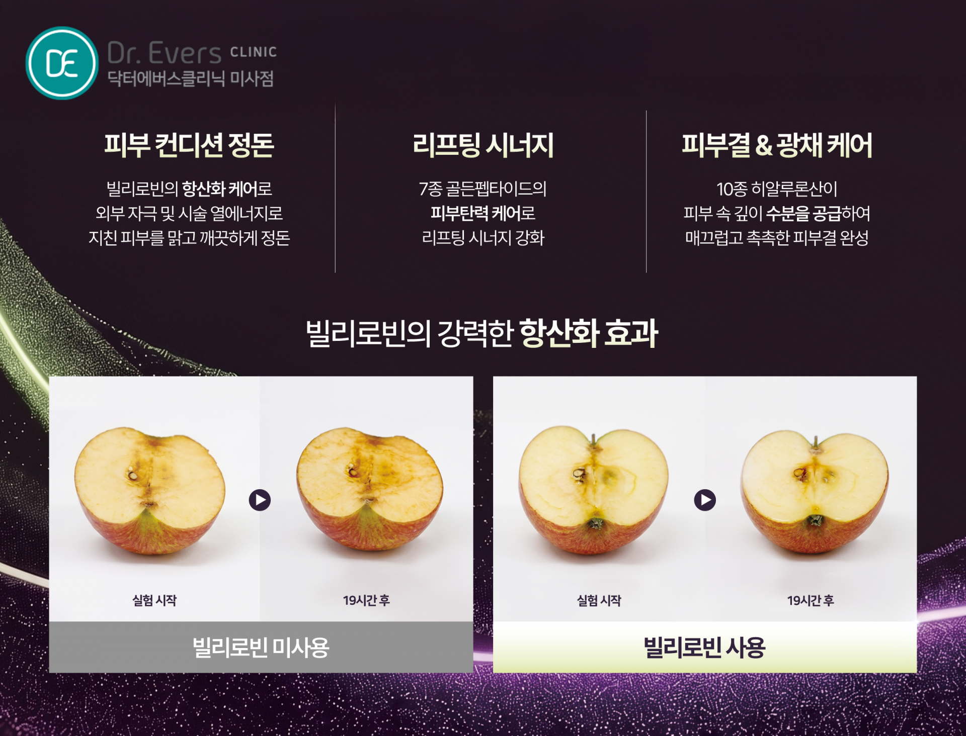 미사 빌리로빈 앰플 성분 피부결 관리 비교_닥터에버스의원